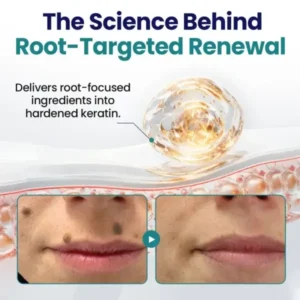 Timilk® WartLift Corn Removal Liquid