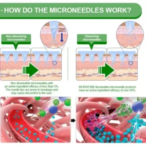 𝑴𝑼𝑹𝑾𝑶𝑵® 𝐀𝐮𝐬𝐬𝐢𝐞 𝐃𝐨𝐜𝐭𝐨𝐫 𝐑𝐞𝐜𝐨𝐦𝐦𝐞𝐧𝐝𝐞𝐝 👨‍⚕️ | 𝗕𝗲𝗿𝗯𝗲𝗿𝗶𝗻𝗲 𝟏𝟎-𝐢𝐧-𝟏 𝗡𝗮𝗻𝗼 𝗠𝗶𝗰𝗿𝗼𝗻𝗲𝗲𝗱𝗹𝗲 𝗣𝗮𝘁𝗰𝗵