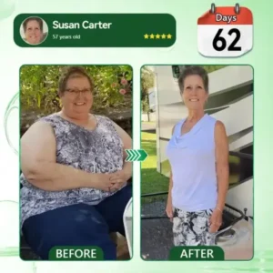 𝑴𝑼𝑹𝑾𝑶𝑵® 𝐀𝐮𝐬𝐬𝐢𝐞 𝐃𝐨𝐜𝐭𝐨𝐫 𝐑𝐞𝐜𝐨𝐦𝐦𝐞𝐧𝐝𝐞𝐝 👨‍⚕️ | 𝗕𝗲𝗿𝗯𝗲𝗿𝗶𝗻𝗲 𝟏𝟎-𝐢𝐧-𝟏 𝗡𝗮𝗻𝗼 𝗠𝗶𝗰𝗿𝗼𝗻𝗲𝗲𝗱𝗹𝗲 𝗣𝗮𝘁𝗰𝗵