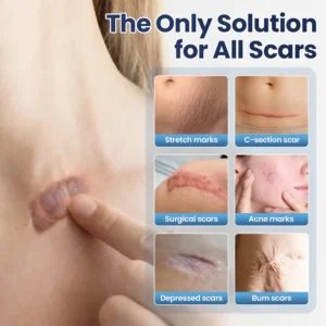 💥50% OFF💥TAILEDEN® Texture Repair Gel