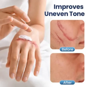 💥50% OFF💥TAILEDEN® Texture Repair Gel