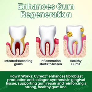 Cvreoz® Propolis Oral Health Spray