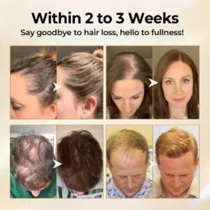 Natravor® CollagenGrow Peptides Hair Growth Spray