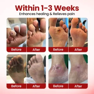 Natravor® VitaGluco Diabetic Care Cream