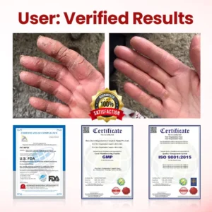 Natravor® VitaGluco Diabetic Care Cream