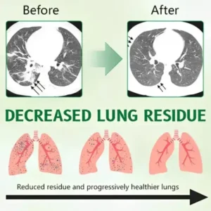 ODEIUN® 3X Concentrated Mullein Lung Cleanse Spray