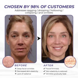 Timilk® ElastaPro Emu Oil Skin Firming Cream