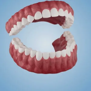 Tiworld™ Advanced Customized Full Denture Set