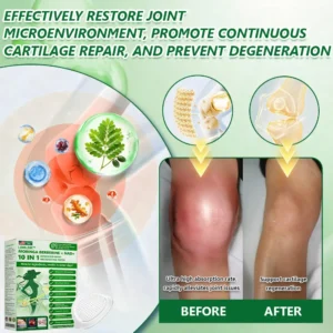 𝐎𝐟𝐟𝐢𝐜𝐢𝐚𝐥 𝐒𝐭𝐨𝐫𝐞 | 🌈🌈LBMLBM® 𝑴𝒐𝒓𝒊𝒏𝒈𝗮 · 𝗕𝗲𝗿𝗯𝗲𝗿𝙞𝙣𝙚 × 𝙉𝘼𝐃+ 𝟏𝟎-𝐢𝐧-𝟏 𝗔𝗱𝘃𝗮𝗻𝗰𝙚𝙙 𝙉𝙖𝙣𝙤 𝙈𝙞𝙘𝙧𝙤𝙣𝙚𝙚𝐝𝐥𝐞 𝐏𝐚𝐭𝙘𝙝 (𝐉𝐮𝐬𝐭 𝐨𝐧𝐜𝐞 𝐚 𝐝𝐚𝐲 — 𝐯𝐢𝐬𝐢𝐛𝐥𝐞 𝐜𝐡𝐚𝐧𝐠𝐞𝐬 𝐢𝐧 𝐚𝐬 𝐥𝐢𝐭𝐭𝐥𝐞 𝐚𝐬 𝟕 𝐝𝐚𝐲𝐬) ✅ 𝐅𝐨𝐫 𝐨𝐛𝐞𝐬𝐢𝐭𝐲, 𝐬𝐤𝐢𝐧 𝐭𝐢𝐠𝐡𝐭𝐞𝐧𝐢𝐧𝐠, 𝐝𝐢𝐚𝐛𝐞𝐭𝐞𝐬, 𝐬𝐥𝐞𝐞𝐩 𝐚𝐩𝐧𝐞𝐚, 𝐣𝐨𝐢𝐧𝐭 𝐢𝐬𝐬𝐮𝐞𝐬, 𝐚𝐧𝐝 𝐦𝐨𝐫𝐞