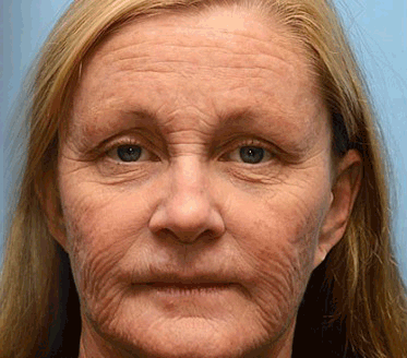 ⚡️ QIAWI™ Firming & Vita-A Retinol Cream✨