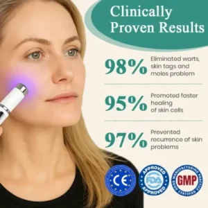 DAFEILA® LumeSkin Mole and Wart Instant Removal Laser Pen ACE 3