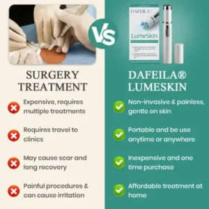 DAFEILA® LumeSkin Mole and Wart Instant Removal Laser Pen ACE 3