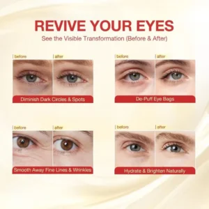 LBMLBM™ Collagen Peptide Lifting Eye Masks – Smooth Wrinkles & Brighten Tired Under-Eyes Fast