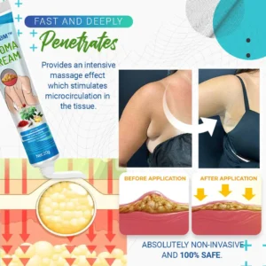 LBMLBM™ Lipoma Removal Cream