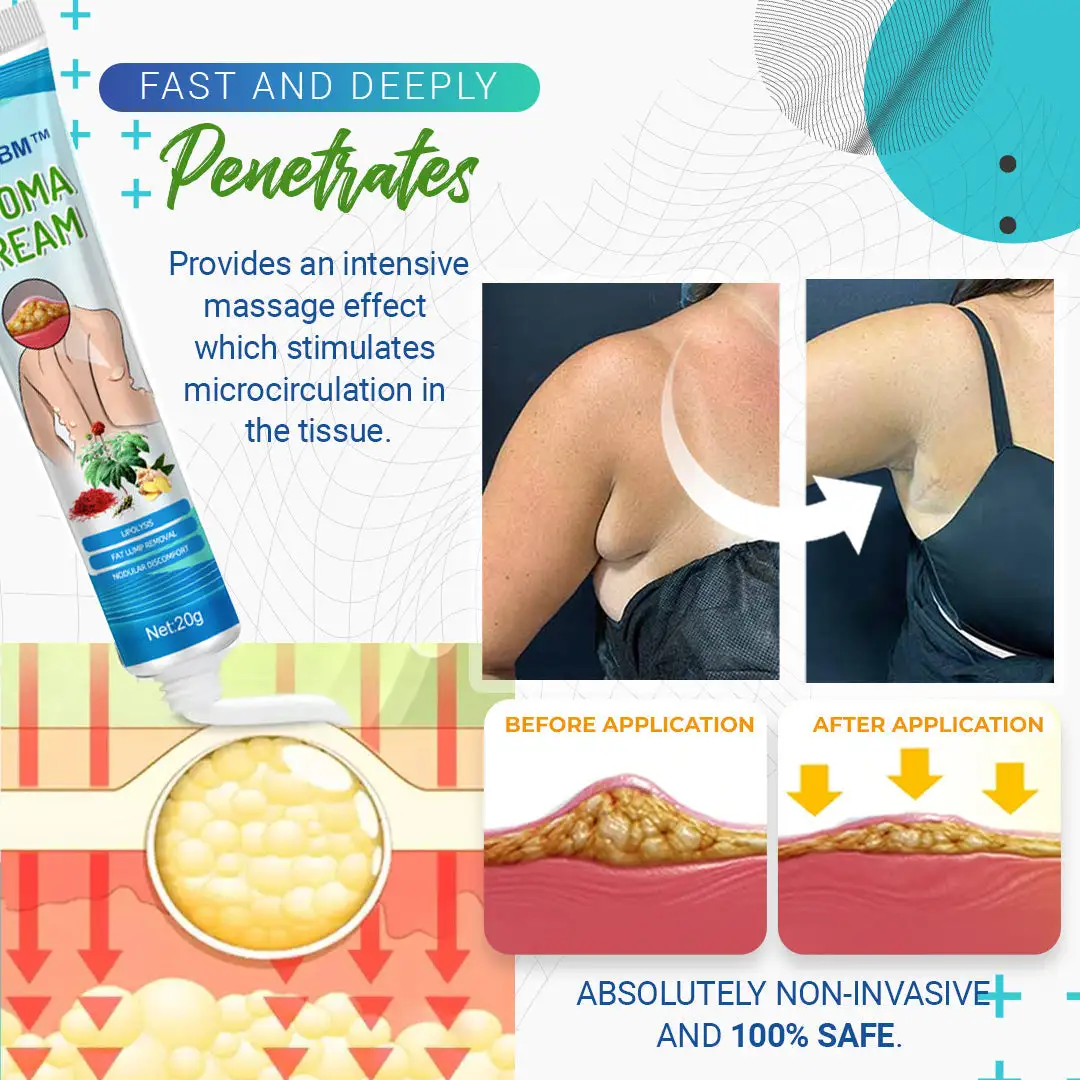 LBMLBM™ Lipoma Removal Cream