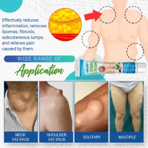 LBMLBM™ Lipoma Removal Cream