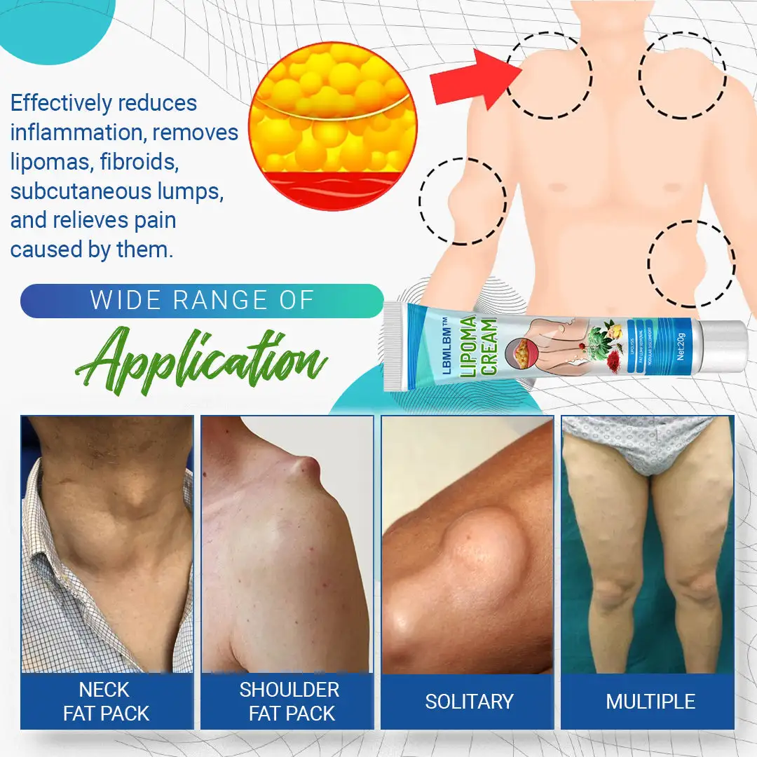 LBMLBM™ Lipoma Removal Cream