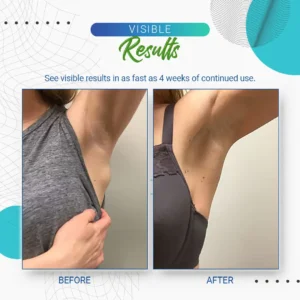 LBMLBM™ Lipoma Removal Cream