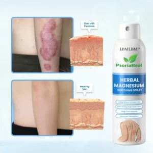 🌿LBMLBM™ PsoriaHeal Herbal Magnesium Soothing Spray⭐