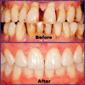 🐝 Dobshow® ApiCore BeeVenom Vital Repair Toothpaste