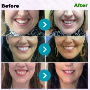 🐝 Dobshow® ApiCore BeeVenom Vital Repair Toothpaste