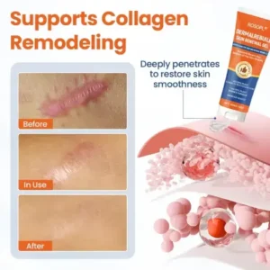 ROSOPL® DermalRebuild Skin Renewal Gel