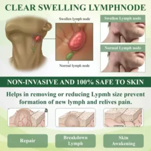 ROSOPL™ Leg Therapy Edema Cream