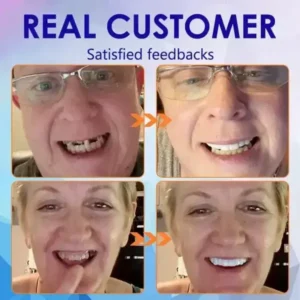 Rosopl™ Ease Dentures