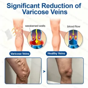 😻TAILEDEN® VeinTarget Microneedle Patch⚡Instant Relief, Long-Term Results