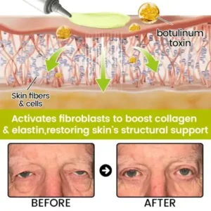 Timilk® Botox Retinol Shot Smoother-Looking Skin for Deep Lines, Sagging Jowls Puffy Eyes
