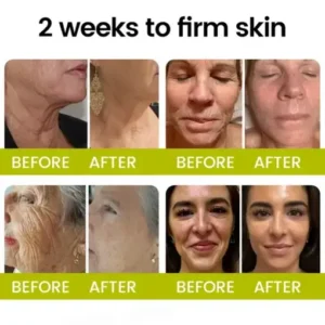 Timilk® Botox Retinol Shot Smoother-Looking Skin for Deep Lines, Sagging Jowls Puffy Eyes